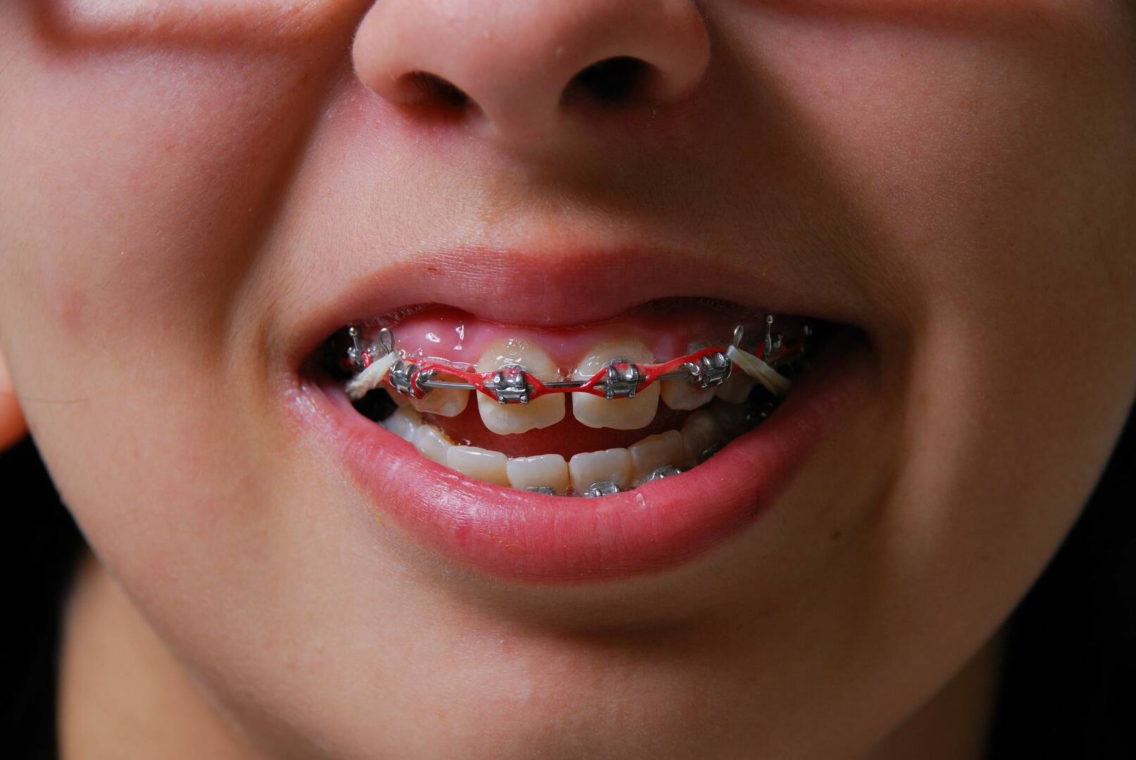 Shades Creek Dental